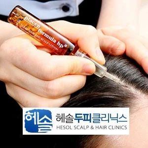 헤솔두피클리닉스 포트폴리오 이미지